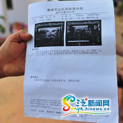 超声诊断报告单(三亚新闻网记者马伟元摄)