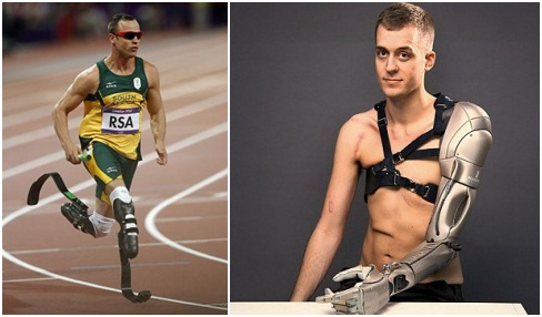 图五 左图为前奥运选手、“刀锋战士”皮斯托瑞斯，右图为一名安装了机械手臂的英国小伙。