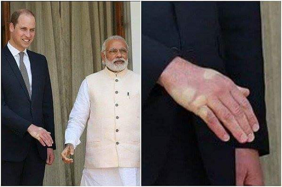 印度总理握手太用力致威廉王子手上留手印（图）