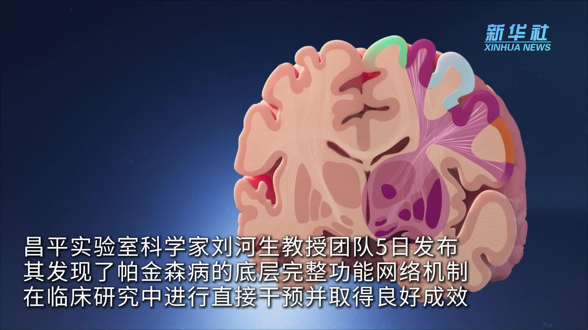 我国科学家世界首次发现帕金森病底层功能网络机制